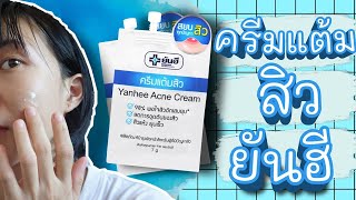 รีวิวครีมแต้มสิวยันฮี Yanhee Acne Cream สิวอักเสบ สิวอุดตัน สิวแห้ง ยุบเร็ว ไปหาลอง  WaanSannie [upl. by Otanutrof]