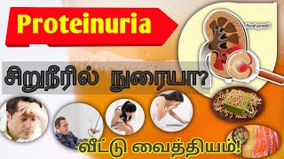 Proteinuria treatment in Tamilfoamy reason in tamilkidney pain location on body in tamilurine [upl. by Aicilf]