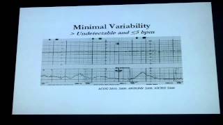 Fetal monitoring review 2 part I [upl. by Tirma]