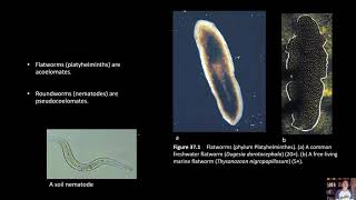 BIOL 1407 Lab 37 Platyhelminthes [upl. by Eniowtna5]