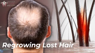 The Science of Hair Loss How to Prevent amp Regrow Lost Hair [upl. by Noral314]