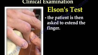 Boutonniere Deformity Elsons Test  Everything You Need To Know  Dr Nabil Ebraheim [upl. by Burnham]