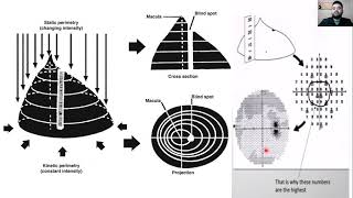 Campos Visuales en Glaucoma 2021 [upl. by Notrab]