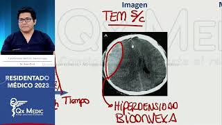 Neurocirugía  3 Hematomas intracraneanos [upl. by Gettings878]