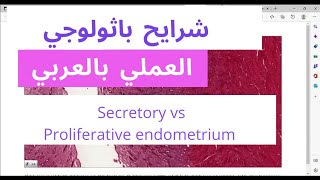 Secretory phase vs Proliferative phase endometrium  histology slide review [upl. by Htiaf]