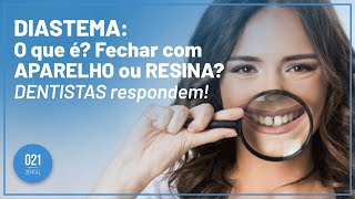 DIASTEMA O que é Fechar com APARELHO ou RESINA DENTISTAS respondem [upl. by Anital]