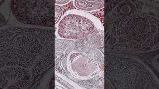 Mastering Tissue Embedding in Histology Proper Tissue Orientation [upl. by Ragas]