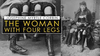 Josephine Myrtle Corbin  The Four Legged Woman [upl. by Meunier]