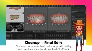 Invisalign ClinCheck  Cleanup plus Final Edits [upl. by Adnorehs]