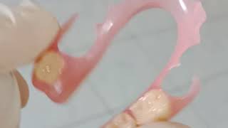 Valplast Flexible Denture [upl. by Arlie]