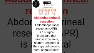 Abdominoperineal resection APR is a surgical trending viralshorts shorts jkottech [upl. by Pradeep]