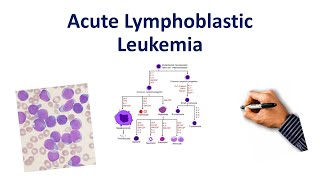 Acute Lymphoblastic Leukemia Mnemonic [upl. by Lednic560]