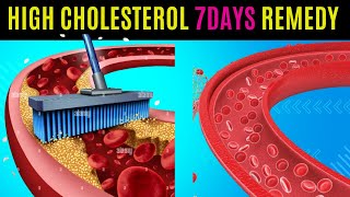 The Most Effective Way to Lower Your Cholesterol Naturally in 7 Days [upl. by Anovad]