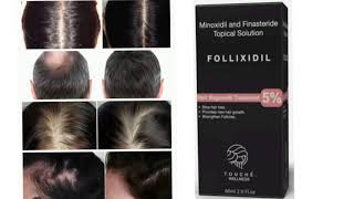 FOLLIXIDIL Topical Solution Minoxidil and Finasteride Topical Solution [upl. by Vincenty993]