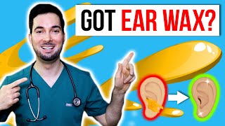 How to remove ear wax in home and clean safely [upl. by Andriette]