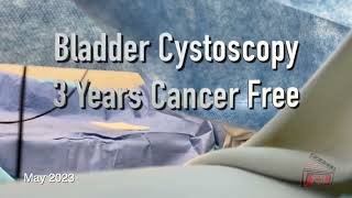 Bladder Cystoscopy Clean 3 years after bladder cancer May 2023 [upl. by Edalb]