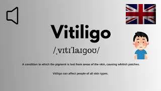 How to Pronounce Vitiligo Correctly  English With Zee [upl. by Blas]