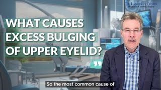 Fatty or Puffy Upper Eyelids Dr Langdon Explains [upl. by Carilla]