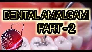 Dental Amalgam Part  2 [upl. by Cone]