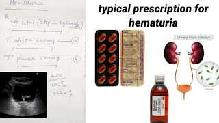 hematuria in male and females treatment and symptoms [upl. by Eineg]