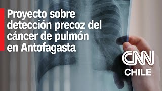 Antofagasta Nuevo proyecto busca detectar precozmente el cáncer de pulmón [upl. by Berri]