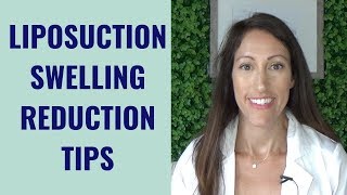 Liposuction Healing amp Recovery Tips  How to REDUCE Lipo Swelling  Post Liposuction Care Guide [upl. by Enehpets234]