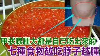 注意！「甲狀腺腫大」都是自己吃出來的 七種食物越吃「脖子越腫」，最好別吃了！ [upl. by Marcie]