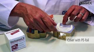 How to prepare a long term denture relining with Molloplast® B [upl. by Assiar]