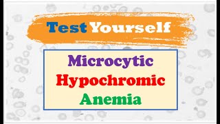 Diffrential Diagnosis 🔷 of Microcytic Hypochromic Anemia [upl. by Noval316]