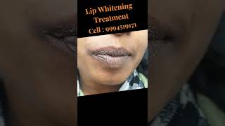 lip lightening lip whitening laser lip lightening lip pigmentation lip whitening treatment [upl. by Treblah]