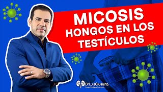 Hongos en los testículos  Micosis en Testículos [upl. by Ahsetan]