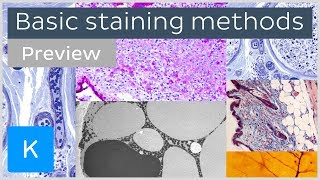 Basic histological staining methods preview  Human Histology  Kenhub [upl. by Ayr]