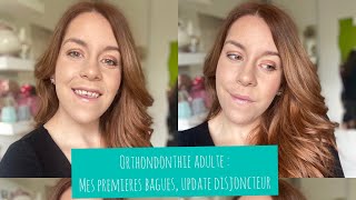 Orthodontie adulte  mes premières bagues  Update Disjoncteur [upl. by Hedve]