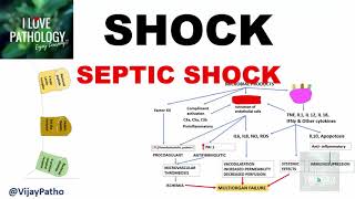 SHOCK Types Pathogenesis of Septic Shock [upl. by Sorrows179]