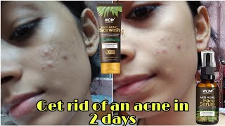 Skin care routine for acne prone skin  Wow skin science antiacne kit review [upl. by Nivlam]