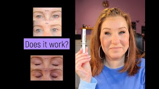 THE ORDINARY MULTIPEPTIDE LASH AND BROW SERUM  30 Day Review [upl. by Kcod249]