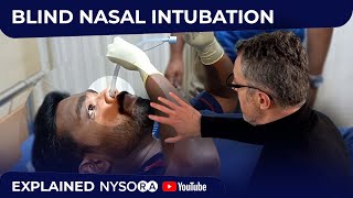 Blind Nasal SelfIntubation  Crash course with Dr Hadzic [upl. by Christoffer679]