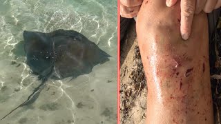 Stingrays Attack How safe is it to swim with stingrays [upl. by Suivatnom]