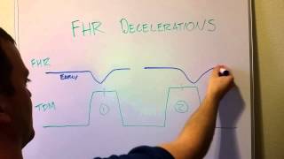 Fetal Heart Rate Decelerations Early Late Variable [upl. by Sej281]