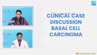 Basal Cell Carcinoma Dr Chesta Agarwal DERMATOLOGY [upl. by Ennayoj]