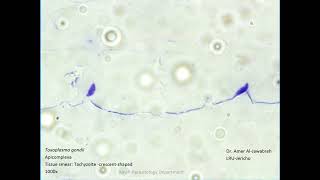 Toxoplasma gondii Tachyzoites [upl. by Inamik]