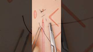 Mixed Sutures 😮 suturepractice surgery vet medicine surgeon stitches funfacts goodtoknow [upl. by Anaihr]