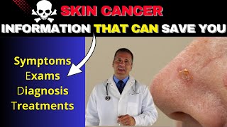 SKIN CANCER INFORMATION THAT CAN SAVE YOU SYMPTOMS EXAMS DIAGNOSIS TREATMENTS [upl. by Palila630]