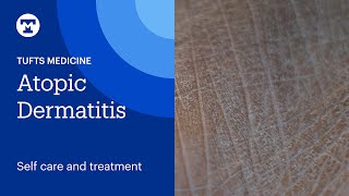 Atopic Dermatitis Self Care and Treatment  Tufts Medicine [upl. by Doe]