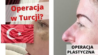 VLOG Operacja plastyczna nosa w Turcji  Eva w Turcji [upl. by Hershel]