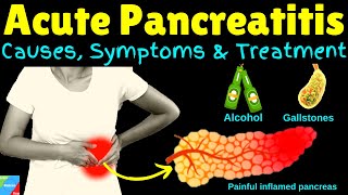 Pancreatitis Acute Pancreatitis – Symptoms Causes Diagnosis Treatment amp Prevention [upl. by Trik981]