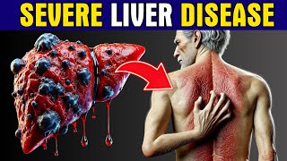 11 Strange Signs of LIVER DAMAGE Healthy Care [upl. by Peggi874]