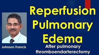 Reperfusion Pulmonary Edema [upl. by Notrub]