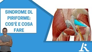 Sindrome del piriforme cosè e come si cura [upl. by Roinuj320]