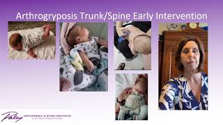 Early Intervention Strategies in the Treatment of Arthrogryposis Pt 1 by Fran Guardo amp Nelda Posada [upl. by Eitsim64]